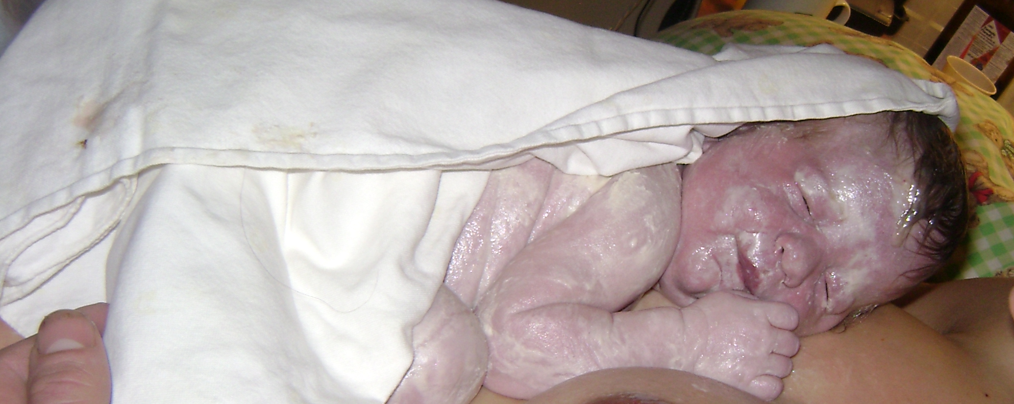 peau à peau coupée